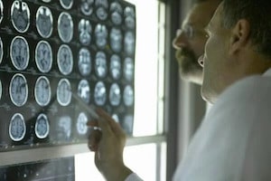 Doctors Reviewing Brain Radiology
